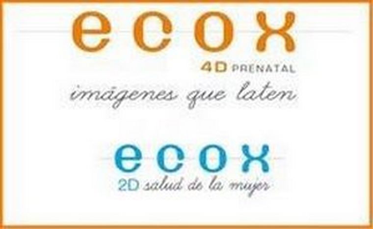 Las ecografías emocionales para embarazadas de Ecox4D  llegan a Alcoy