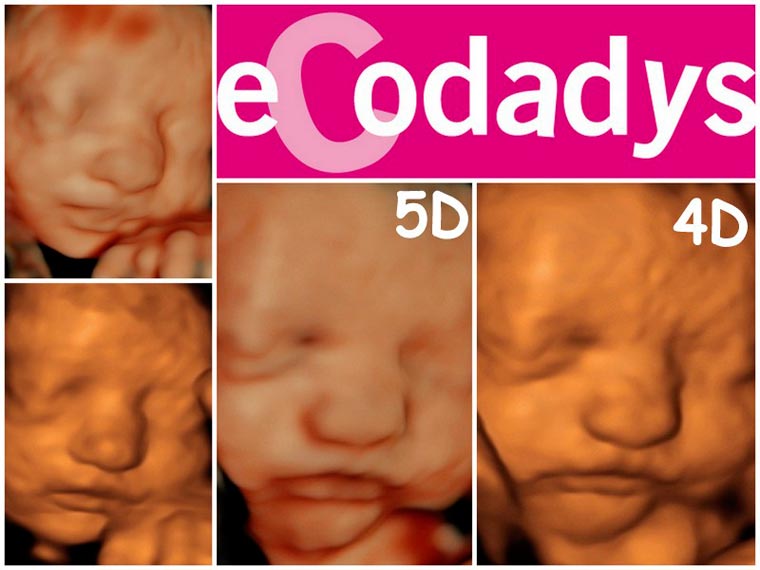 Próxima apertura de la franquicia Ecodadys en Santander